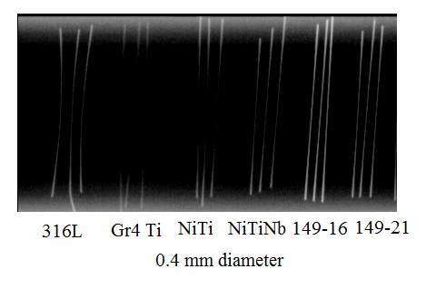 radiopacity of different alloys